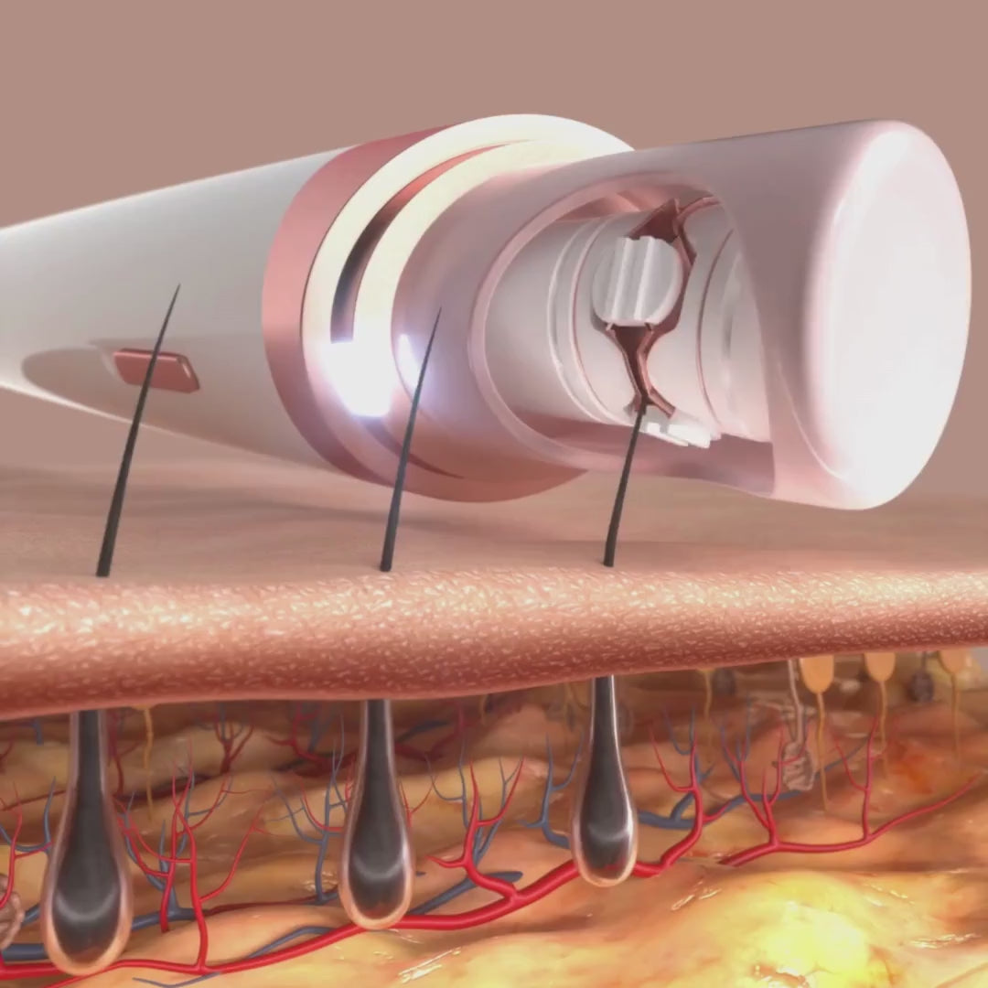 Charger la vidéo : 